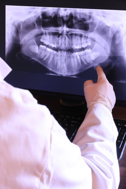 Best Emergency Tooth Extraction in Nicholson, GA